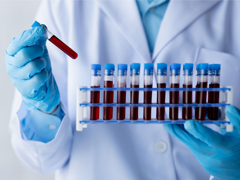 ematologia centro medico blugallery san severino marche